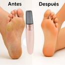 Removedor de Callos Eléctrico Recargable – ¡Pies Suaves al Instante y desde casa!